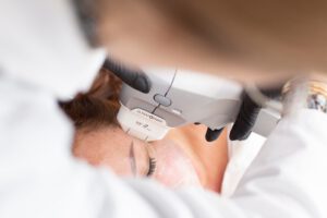 Ultraformer MPT Procedure